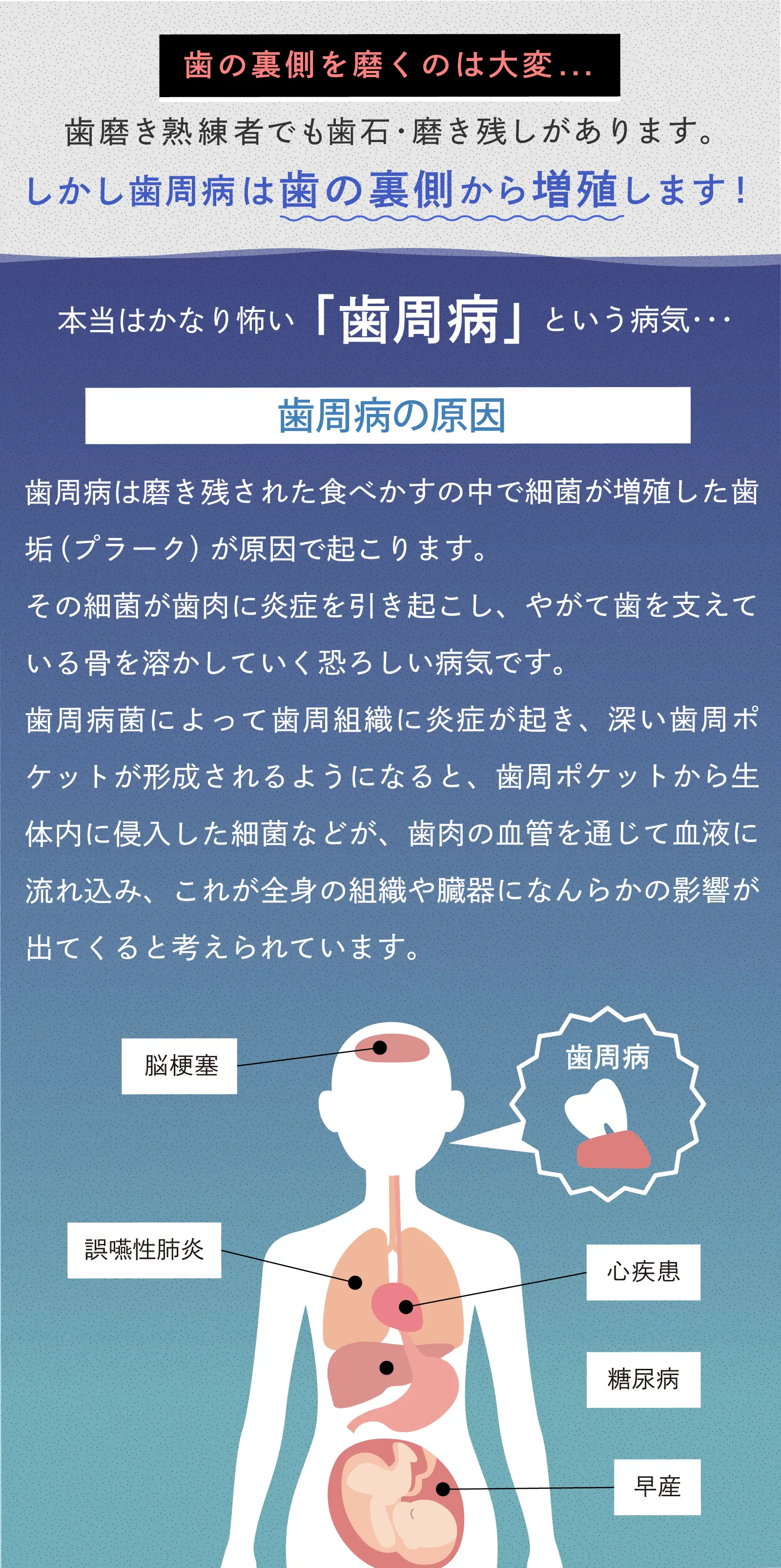 歯周病という病気