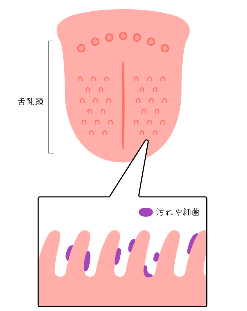 舌には数千億の細菌